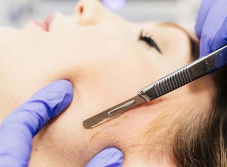 a professional uses a fine, medical-grade blade to gently scrape away the top layer of dead skin and vellus hair (peach fuzz) in our clinic in calgary