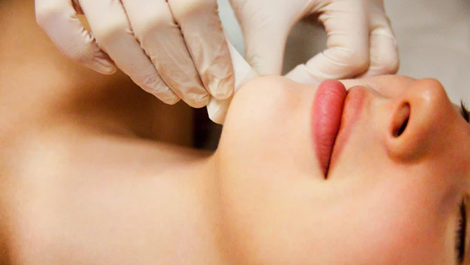 Wax_Facial_waxing_Chin_hair_removal__NYC-2_zpshsntbybx