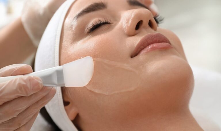 chemical peel is for radiant looking skin and for resolving Fine lines, wrinkles and Acne